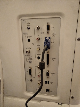 УЗИ сканер Samsung SA-8000 (Medison) б/у